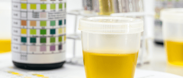 Guide to Urine Drug Tests | GoodHire