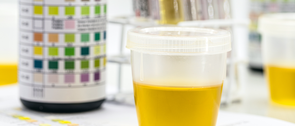 Urine Drug Testing Facts: What You Need to Know